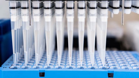 Different test methods for diagnosing the coronavirus